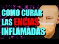 Como CURAR la INFLAMACIÓN de ENCÍAS 👈 gingivitis y periodotitis