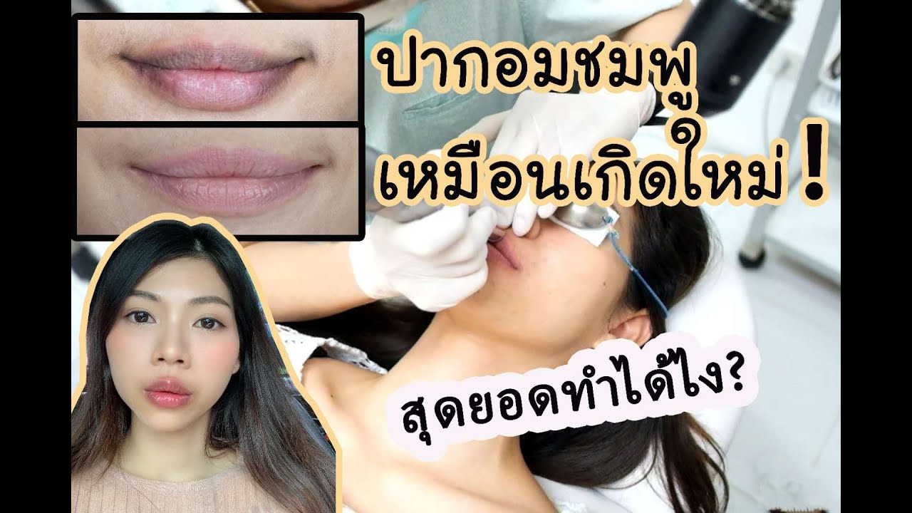 เลเซอร์ปากชมพู บอกหมดไม่มีกั๊ก!|SichatStory