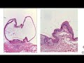 Dermpath 11 Dr Rania Elakad 