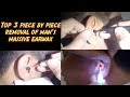 Top 3 Piece by Piece Man's Massive Earwax Removal