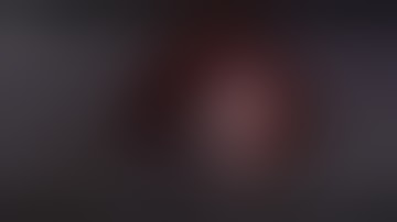 Lateral Bone Augmentation demonstration with OSSIX™ Bone & OSSIX® Plus