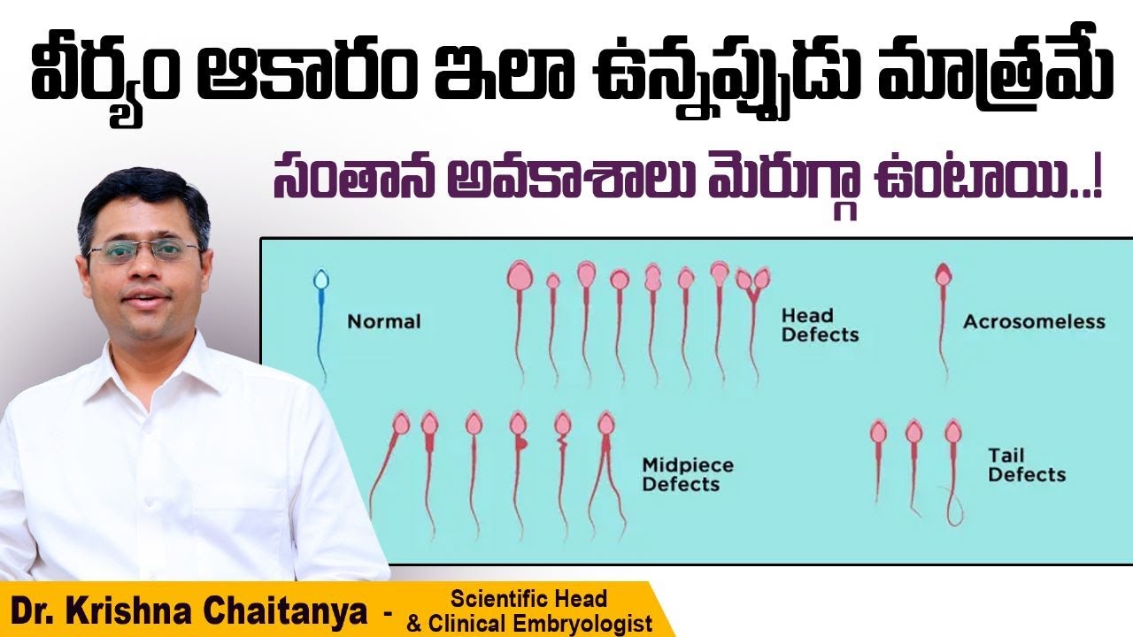 what-is-teratozoospermia-sperm-morphology