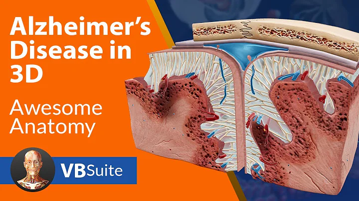 Visible Body | Alzheimer's Diseases in 3D