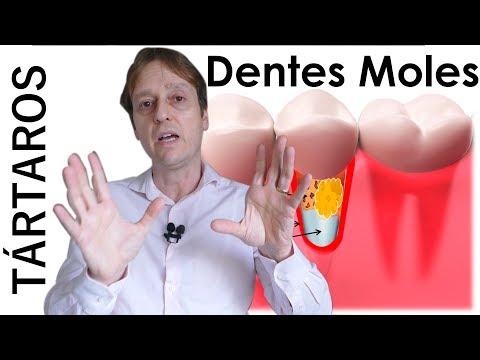 Vídeo: Dentes negligenciados podem ser salvos?