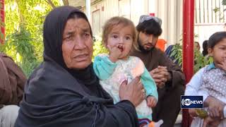 Children with cleft lips treated for free in Helmand | تداوی کودکان لب چاک به گونه رایگان در هلمند screenshot 3