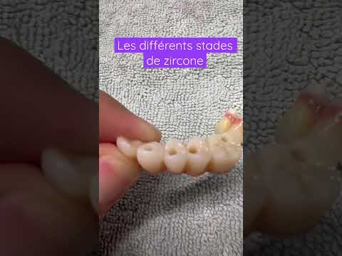 Zircone, tous les