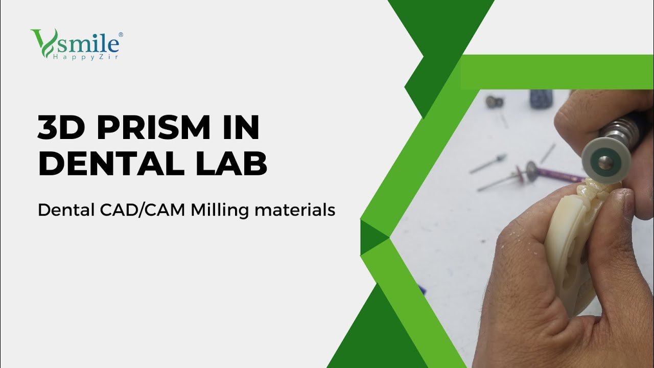 Vsmile 3D Prism in Dental Lab Dental Technician YouTube