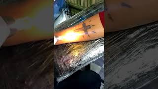 permanent Tattoo Removal by Lemon Tattoo Tinsukia Assam India ️ 8433817335