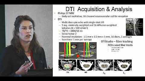 Kathleen M. Zackowski, Ph.D., O.T.R. presentation ...