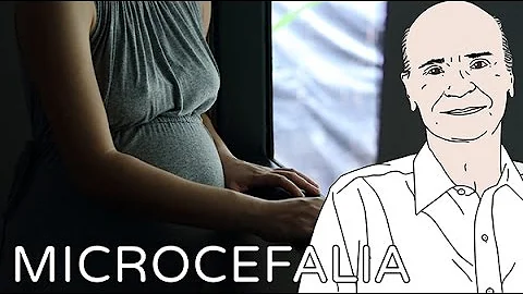 Quais são os tipos de microcefalia?
