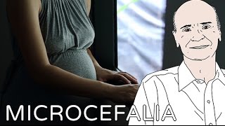 Microcephaly | Column #34