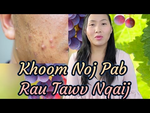 Khoom Noj Pab Tawv Nqaij by Ncais Vang