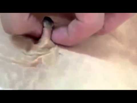 Belly Button Lint 巨大なへそのゴマ Kak Pozdravit S Dnem Rozhdeniya