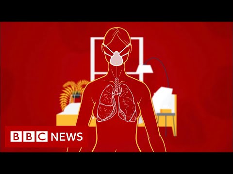 Coronavirus: How long does it take to recover? – BBC News