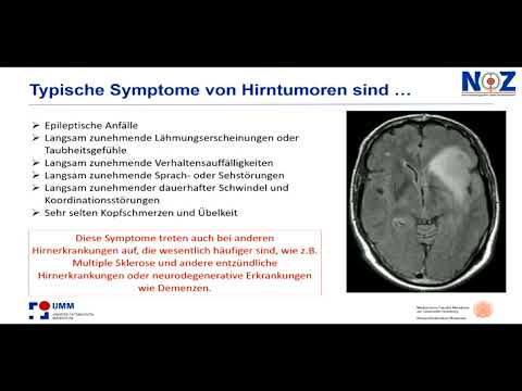 Video: Einfache Möglichkeiten, einen Hirntumor zu erkennen (mit Bildern)