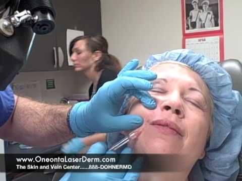 Botox and Juvederm for Facial Wrinkles