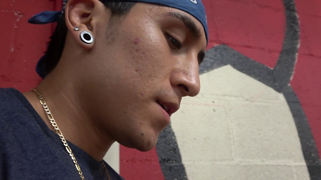 Does Boxing Cause Brain Damage? EsNews Boxing