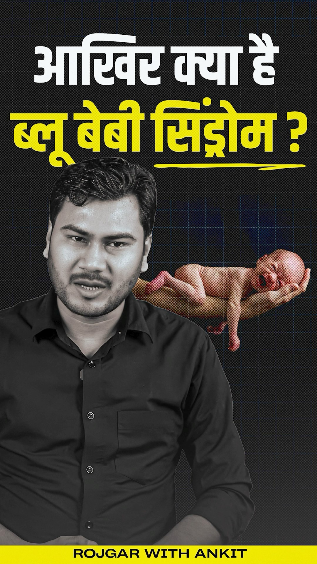 क्या है Blue Baby Syndrome ? | Blue Baby Syndrome Explained By Vivesh Sir
