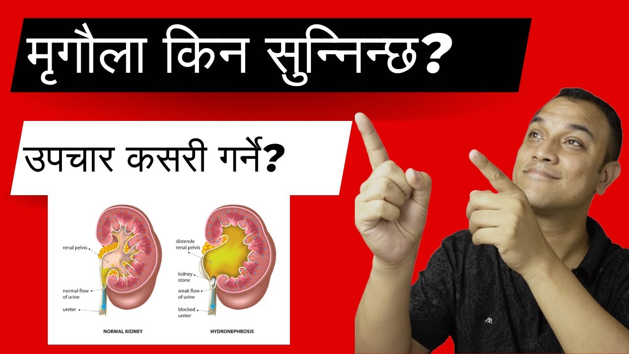 Почему опухают почки? Как лечить? Опухшие почки? Доктор Дивакар Манандхар