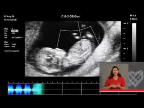 Видео: Мога ли да пия бира по време на бременност?