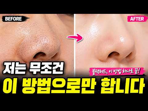 피지연화제 솔직사용후기