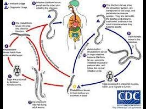 Video Giun Lươn Giun tóc (Trichuris trichiura) Giun kim (... - youtube