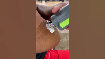 The Guardian 4 Sensor With The MiniMed780G Pump Gives Kris Confidence To Manage His T1D 