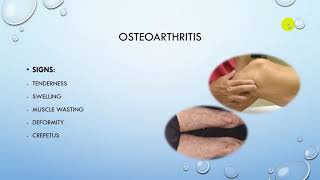 osteoarthritis / Dr. MOHD SAID Dawod