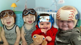 Babies With Flat Head Syndrome Get Fun Helmets