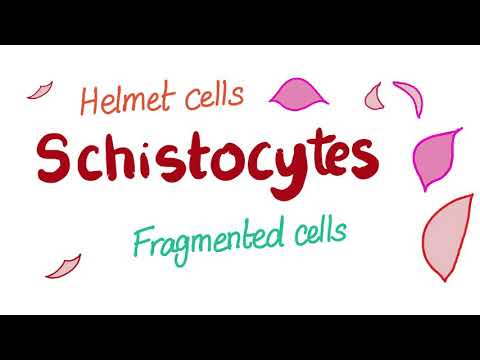 What S A Schistocyte Aka Helmet Cell Or Fragmented Cell Youtube