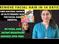 Remove Facial Hair In 14 Days || 💯 Proved Natural Method  || முகத்தில் உள்ள தேவையற்ற முடியை நீக்க