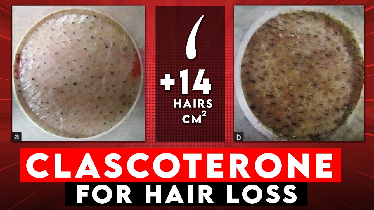 Класкотерон «539%» для роста волос… Вот правда.