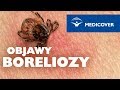 Borelioza: objawy boreliozy