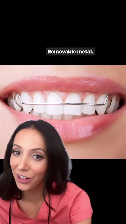 different types of retainers #shorts