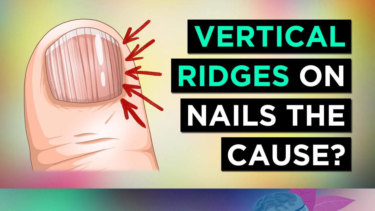 Are your fingernails yellow or brittle? You may have serious health issues