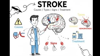 Stroke Animated | Causes, Signs, Types & Treatment – Explained with diagrams | Must Watch!