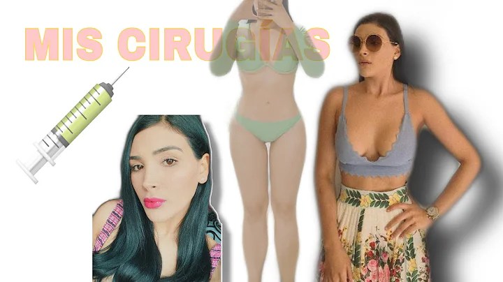MIS CIRUGAS ( Mi experiencia + mi opinin )