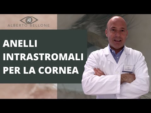 Anelli intrastromali per la cornea - Cura del cheratocono