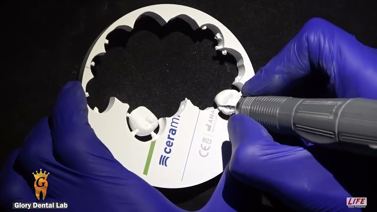 تعرف كيف يتم صناعة تركيبات الأسنان فى خطوات بسيطة - تصوير من داخل معمل جلوري