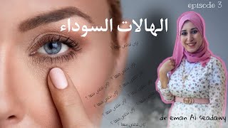 ازاى نتخلص من الهالات السوداء | how  to get rid of the black halos