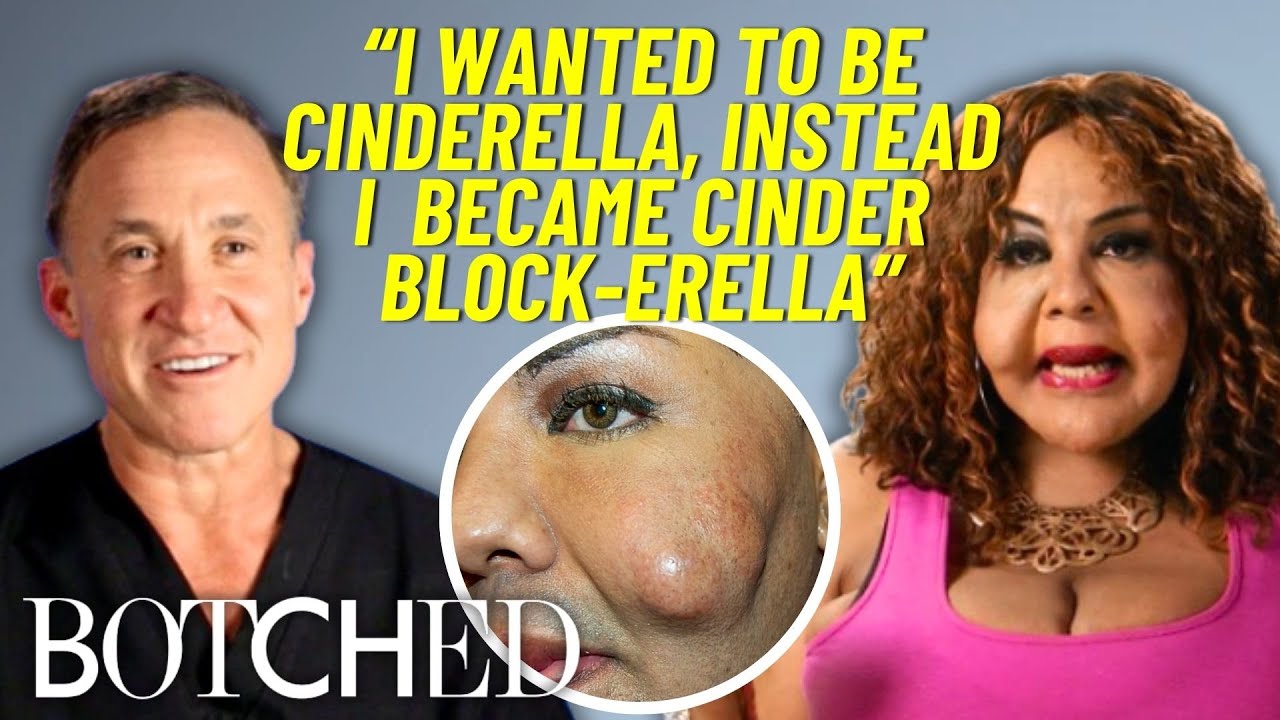 REJECTED by Botched: Rajee’s First Attempt At Removing Cement Filler Injections | Botched | E!