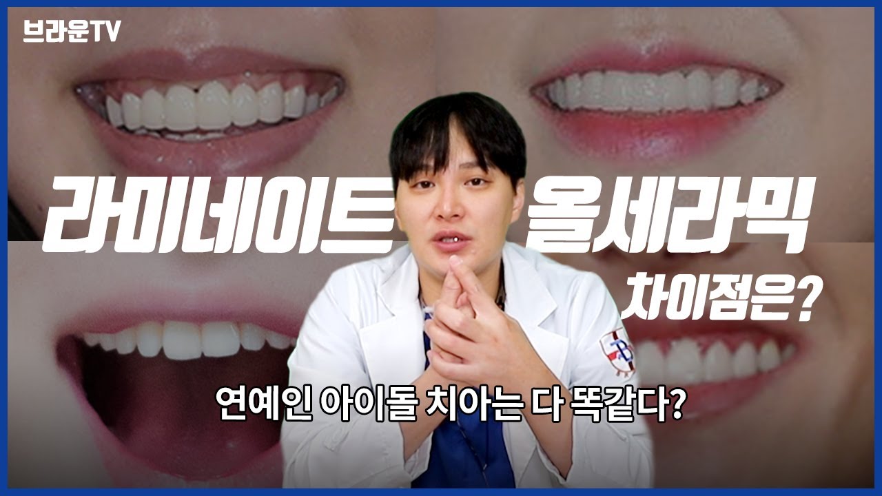 Gaoyang 치과 용 라미네이트와 올 세라믹의 차이점 5