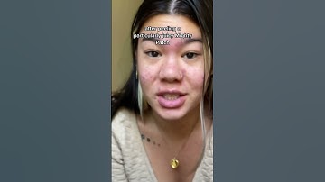 Do pimple patches actually work?
