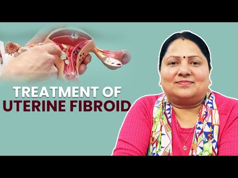 Video: Typer Av Fibroids - Desmoid Fibroma, Ikke-ossifying, Ikke-osteogenic Og Cystisk Fibroma