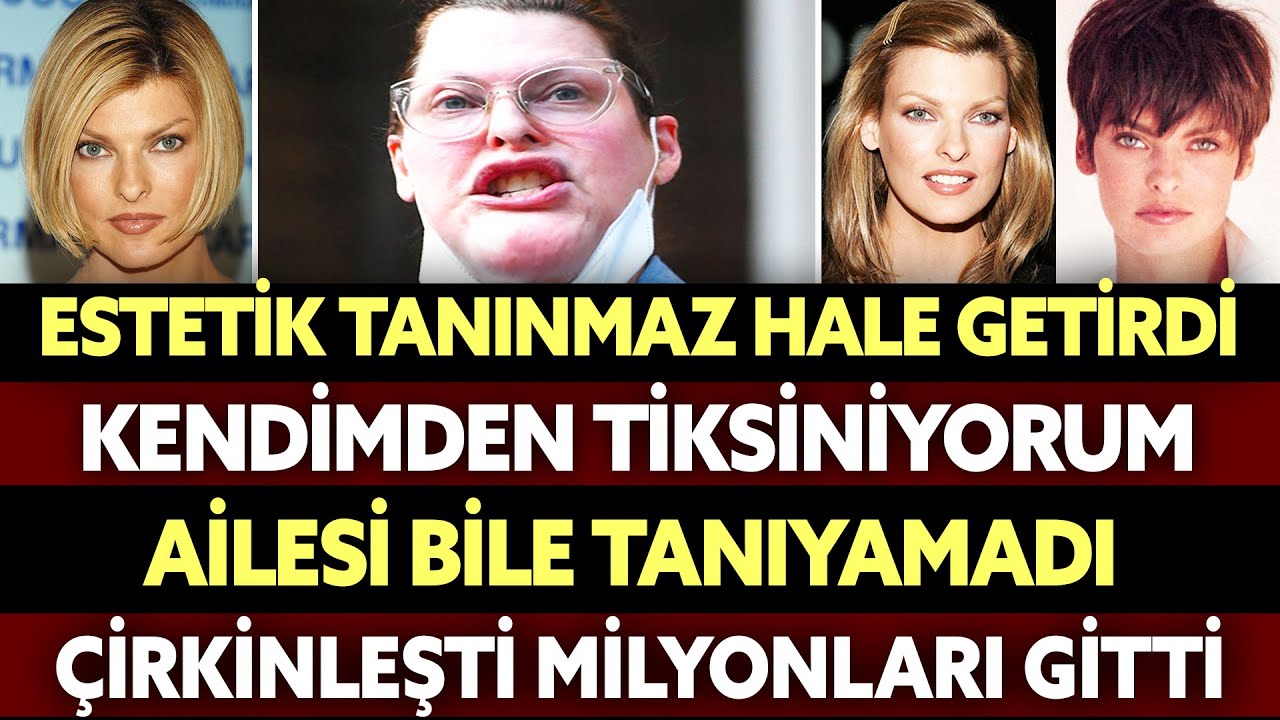 Milyarder Süper Model, Şimdi Aynaya Bakamıyor. 