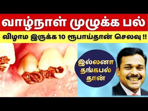 பல் துலக்கினால் மட்டும் பத்தாது! வாழ்நாள் முழுக்க சொந்த பல்லோடு இருக்க இந்த 5 பழக்கங்கள் கட்டாயம்!