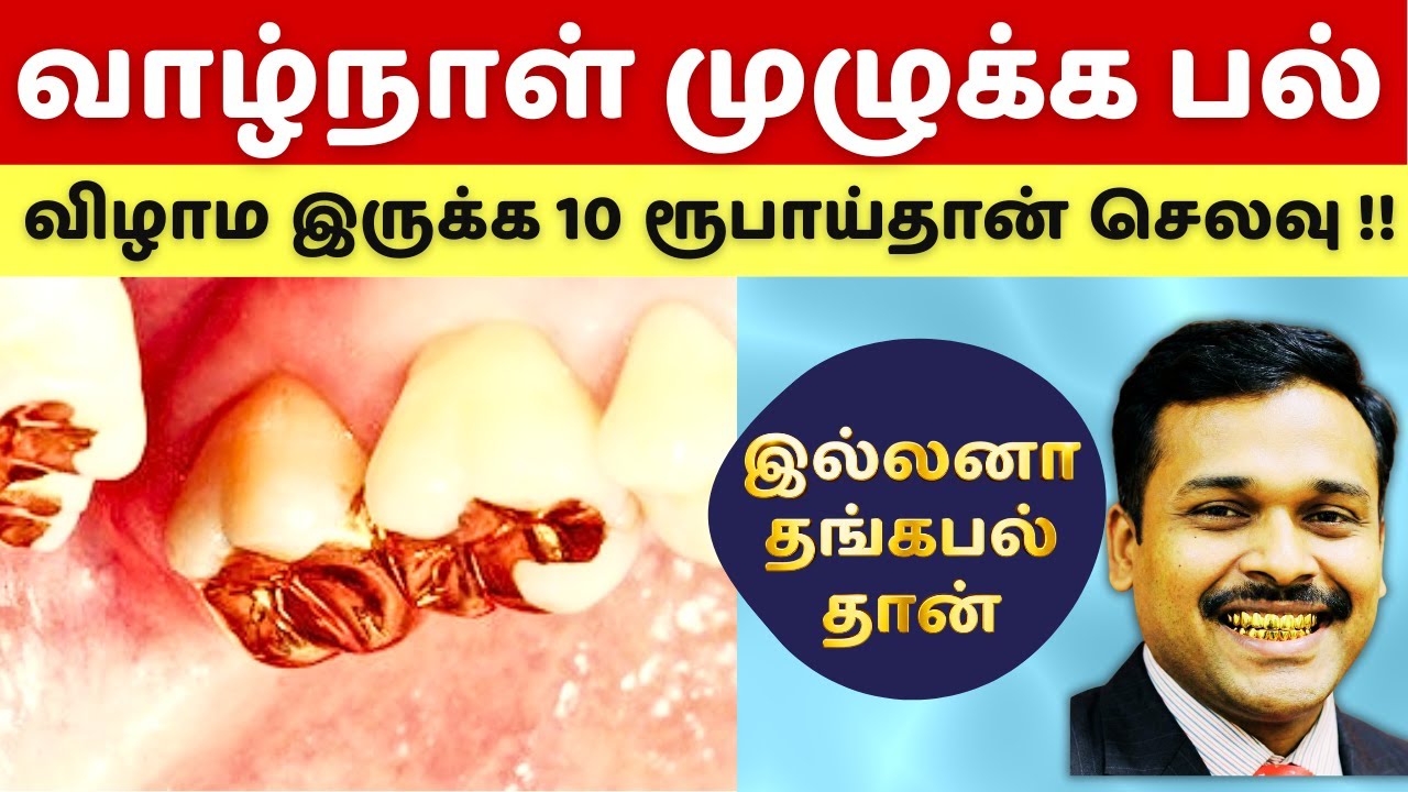 பல் துலக்கினால் மட்டும் பத்தாது! வாழ்நாள் முழுக்க சொந்த பல்லோடு இருக்க இந்த 5 பழக்கங்கள் கட்டாயம்!