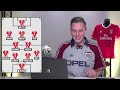 FC Bayern: Hat Kompany das Benfica-Spiel vercoacht?! | Klub-WM Analyse