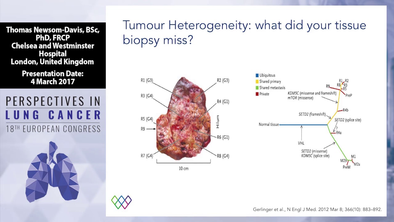 Debate Liquid Biopsy Will Replace Tissue Biopsy Yes YouTube