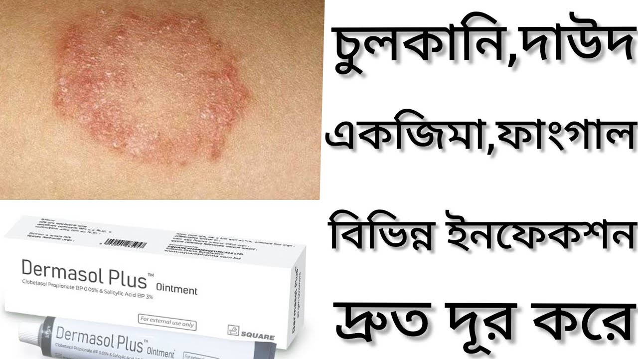 Dermasol Plus Ointment/দাউদ একজিমা চুলকানি দূর করার ঔষধ কি/Dermasol Plus Cream এর কাজ কি